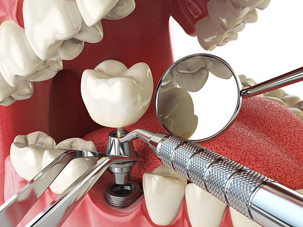 Best Weekend Emergency Dentist in Mountain View, NC